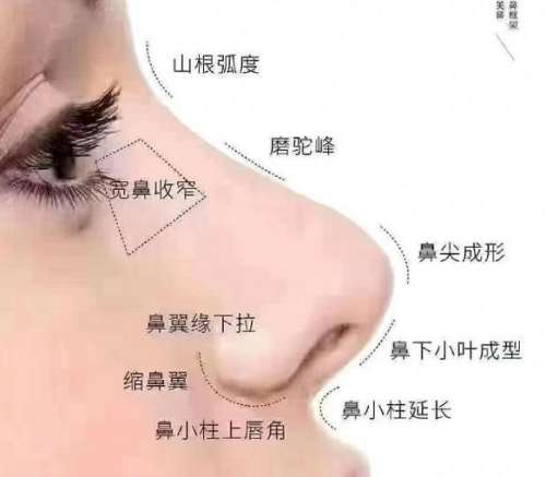 广州做鼻子多少钱？2026价目表揭晓！硅胶隆鼻13000-18000元起