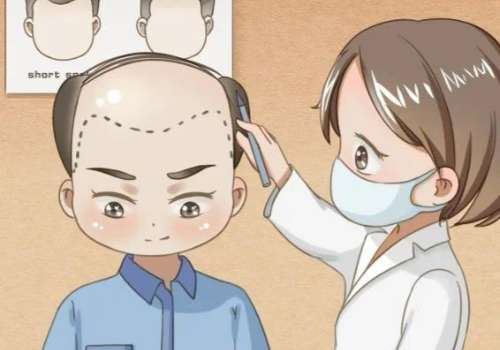 泰安中心医院植发多少钱？低至8k起、张琳医生领衔_口碑高！