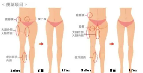 哈尔滨艺星和瑞丽哪个好？真实的客户口碑对比！