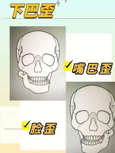 嘴巴歪整形大概多少钱