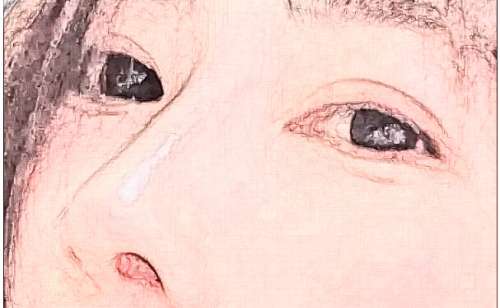 西安眼部美容哪家好？壹加壹、画美、繁星优选等不错