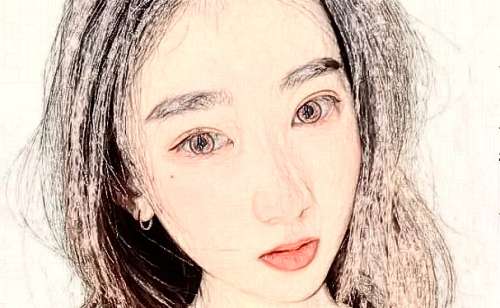 北京协和医院切眼袋技术怎么样?多少钱?恢复案例