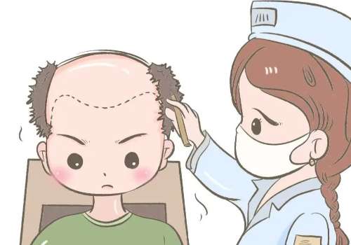 浙江衢化医院植发怎么样？倪良方技术稳定_案例多_口碑高！