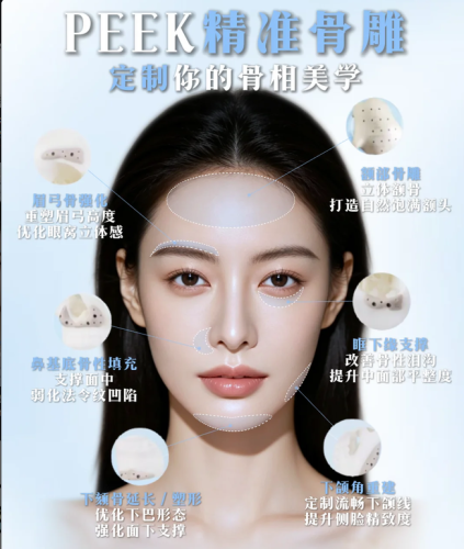 苏州peek下巴多少钱？26年价格4万元起，含9月口碑医院测评
