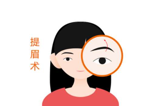 重庆提眉手术好的医生推荐！张家平、王朝奎、樊东力不错