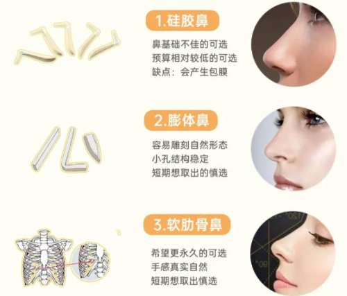 长春隆鼻子要多少钱？隆鼻费用低至1万4左右起！报价标准全整理