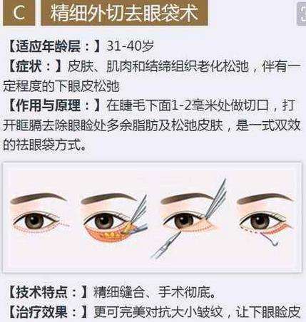 山东做手术去眼袋要花多少钱？价格参考是3000到800元不等