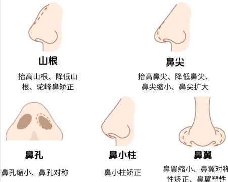 重庆取鼻假体好的医生三甲名单公布！王量、果磊、樊东力等测评公布