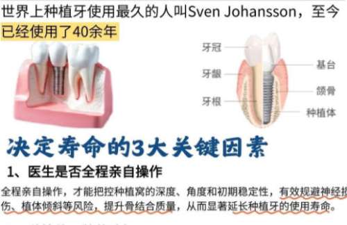 沈阳种牙价格一般多少钱?价格低至4k起有可靠医院详解来袭!