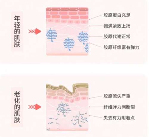 珠海打胶原蛋白多少钱？泪沟 /法令纹填充价格参考！新手必看