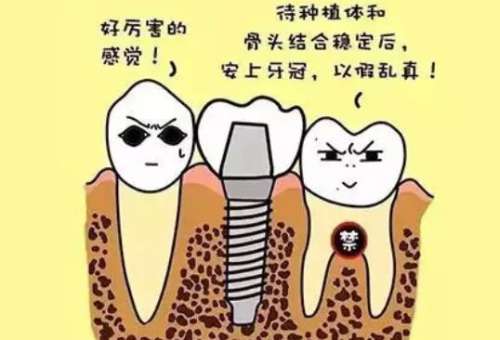 榆林种一颗牙大概要多少钱？种植牙医院哪家好
