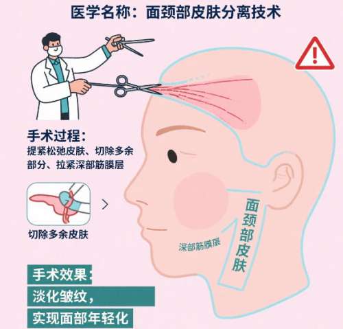 西安脸部拉皮手术多少钱？价目表更新！含2026热门医院名单