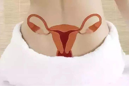 女性慢性宫颈炎