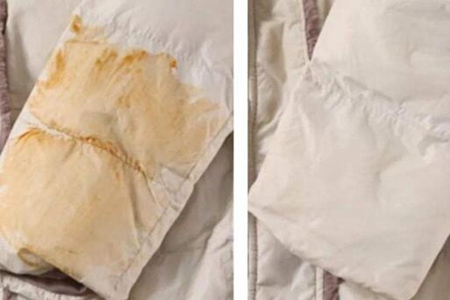 腰椎间盘突出的症状是什么？这五个症状表现要及时改善治疗